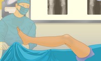 Chirurgie du genou