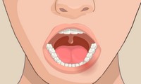 Chirurgie des dents